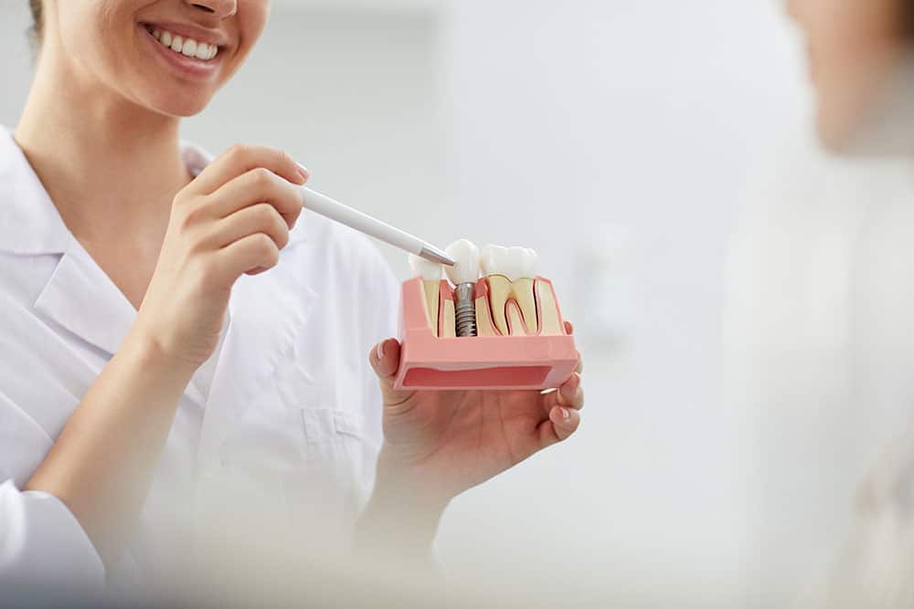 nashville dental implants dental implants implant West Meade Dental dentist in Nashville Tennessee Dr. Allison Kisner