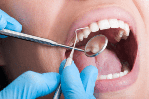 preventative dentistry West Meade Dental dentist in Nashville Tennessee Dr. Allison Kisner