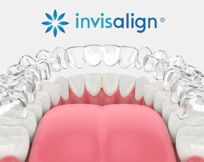 Explore Modern Smiles With Invisalign in Nashville