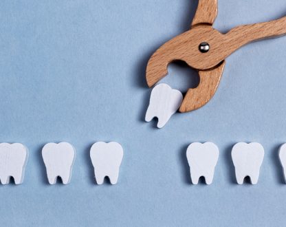What to Expect After a Tooth Extraction